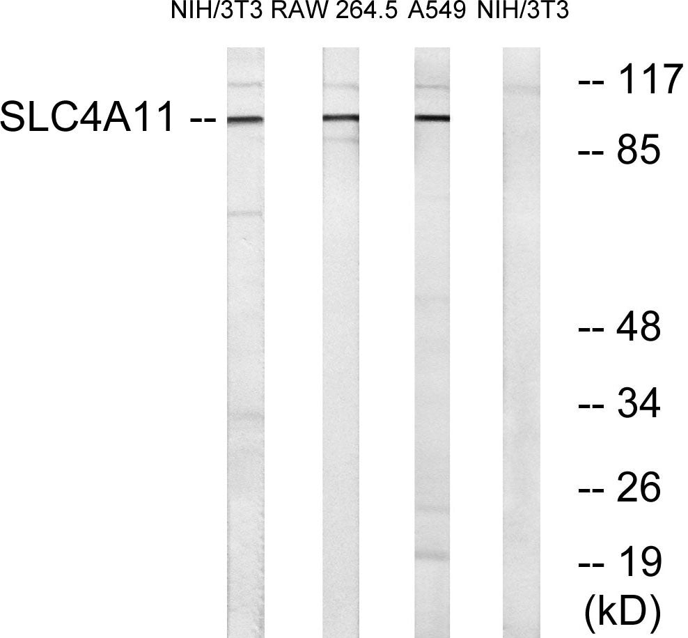 BTR1 Rabbit Polyclonal Antibody