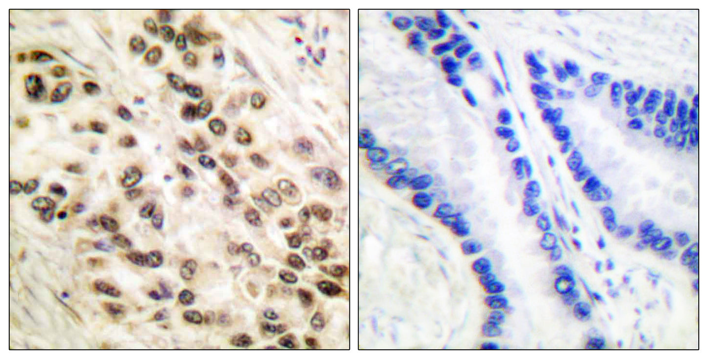 C/EBP β Rabbit Polyclonal Antibody