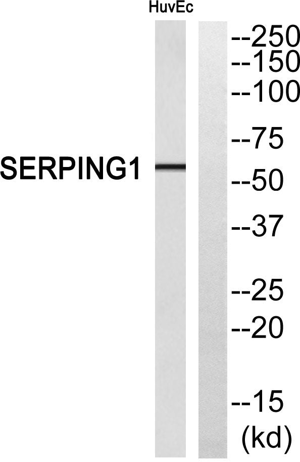 C1INH Rabbit Polyclonal Antibody