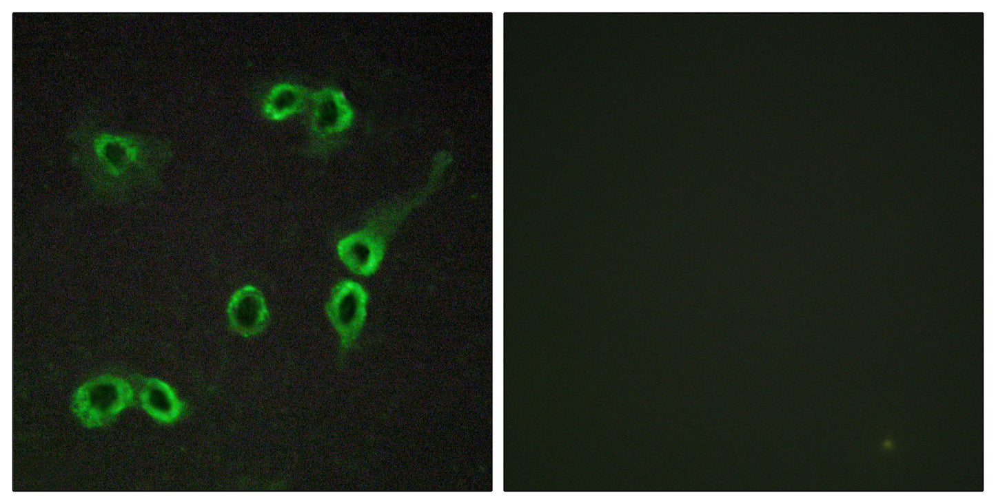 C3aR Rabbit Polyclonal Antibody