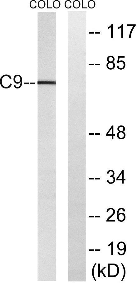 C9 Rabbit Polyclonal Antibody