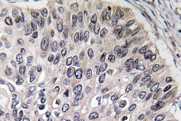 CA II Rabbit Polyclonal Antibody