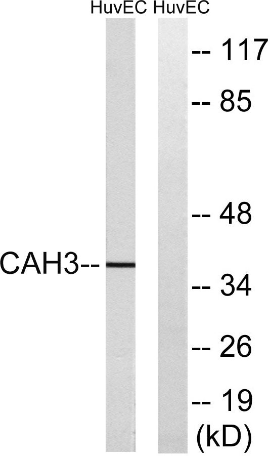 CA III Rabbit Polyclonal Antibody