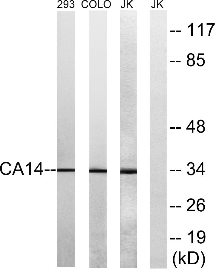 CA XIV Rabbit Polyclonal Antibody