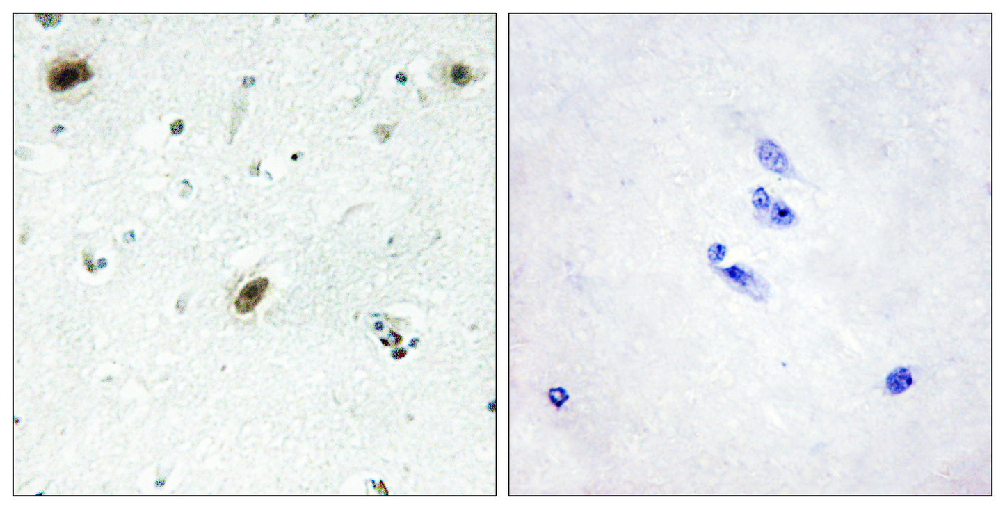 c-Abl Rabbit Polyclonal Antibody