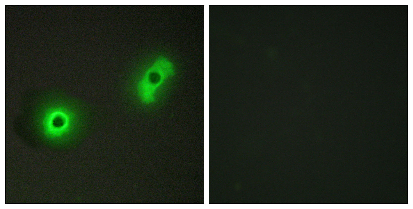 Cables2 Rabbit Polyclonal Antibody