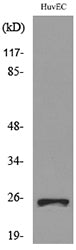 CacyBP Rabbit Polyclonal Antibody