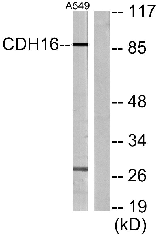 Cadherin-16 Rabbit Polyclonal Antibody