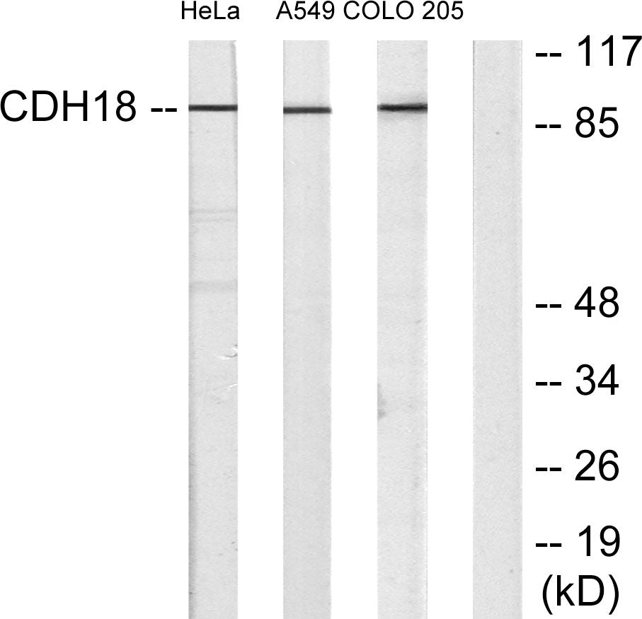 Cadherin-18 Rabbit Polyclonal Antibody