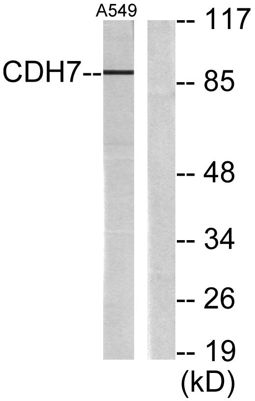 Cadherin-7 Rabbit Polyclonal Antibody