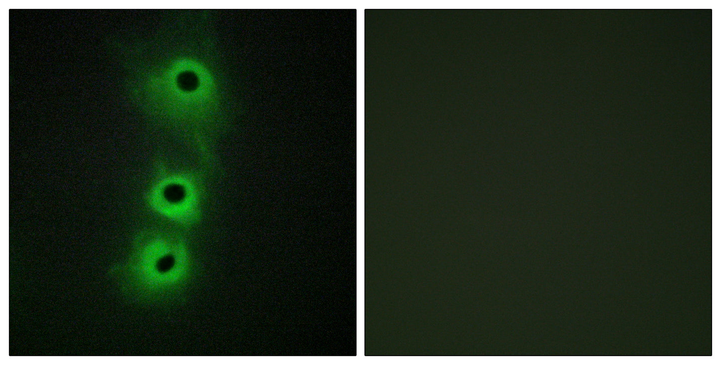 Cadherin-8 Rabbit Polyclonal Antibody