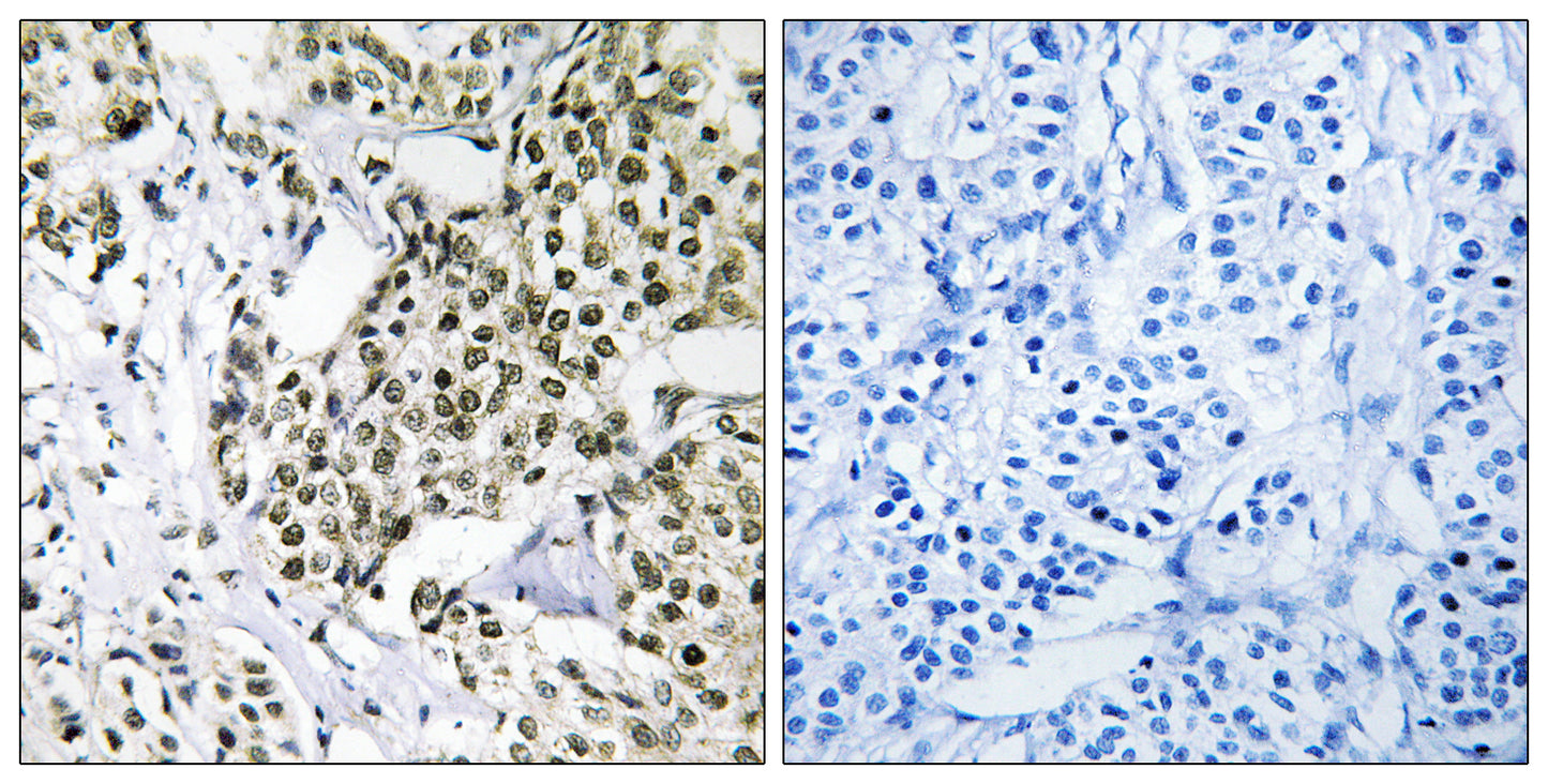 CAGE-1 Rabbit Polyclonal Antibody
