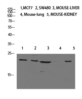 Calcitonin Rabbit Polyclonal Antibody