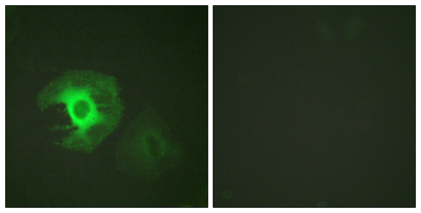 Caldesmon Rabbit Polyclonal Antibody