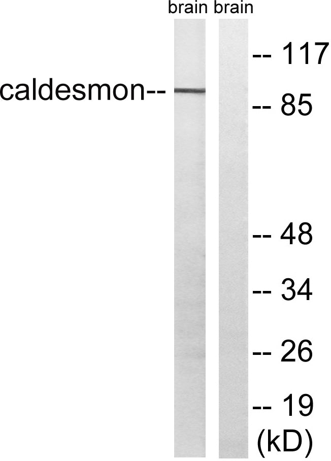 Caldesmon Rabbit Polyclonal Antibody