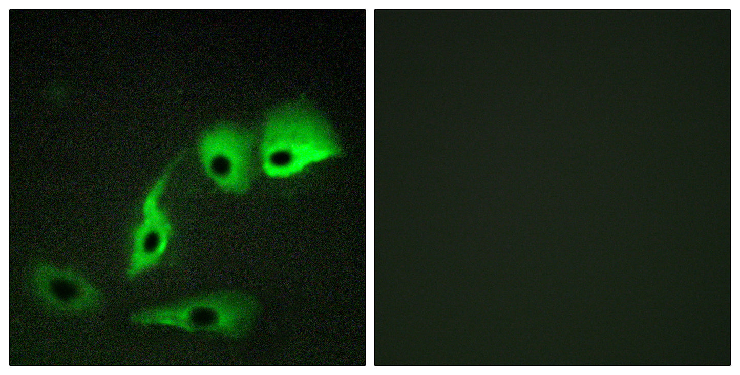 Calmodulin Rabbit Polyclonal Antibody