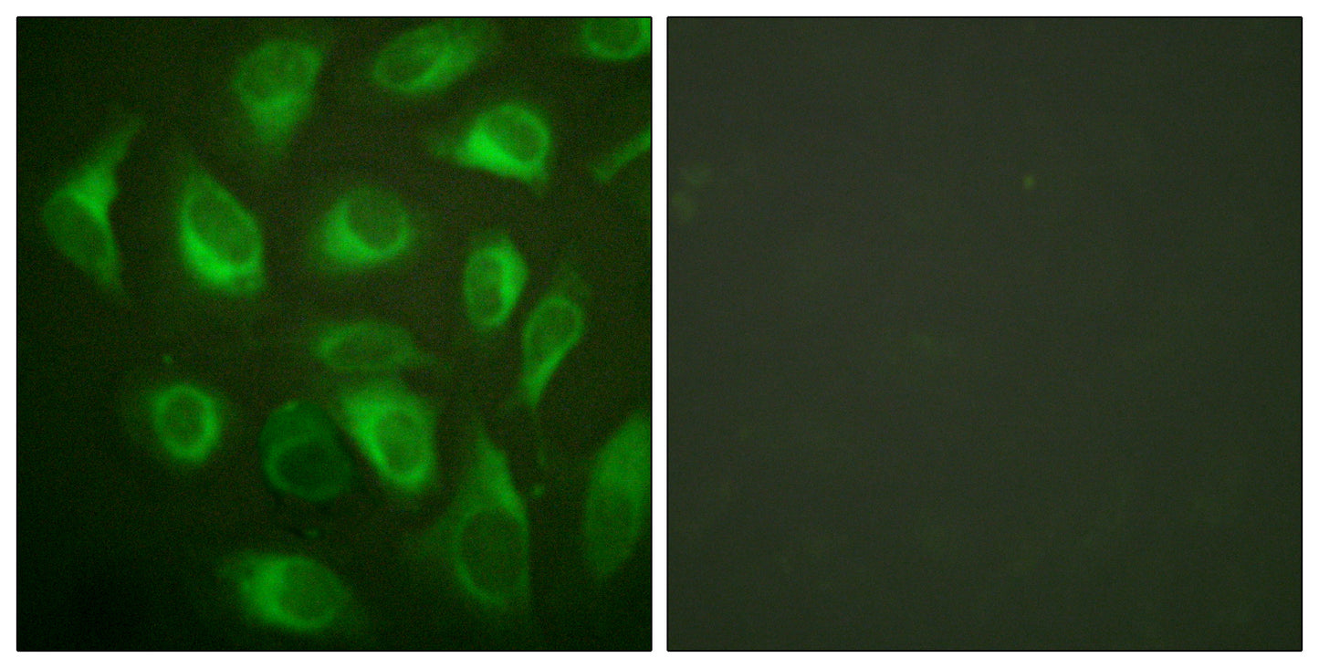 Calnexin Rabbit Polyclonal Antibody
