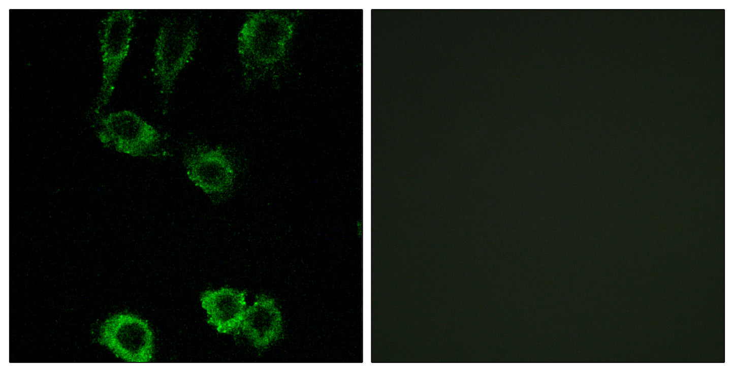 Calponin 2 Rabbit Polyclonal Antibody