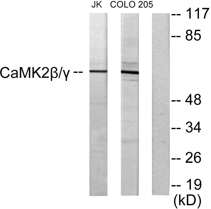 CaMKIIβ/γ Rabbit Polyclonal Antibody