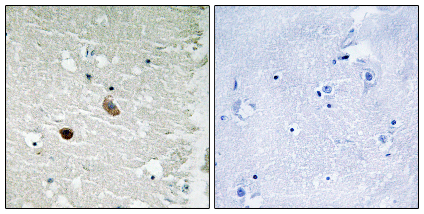 CaMKIIβ/γ/δ Rabbit Polyclonal Antibody
