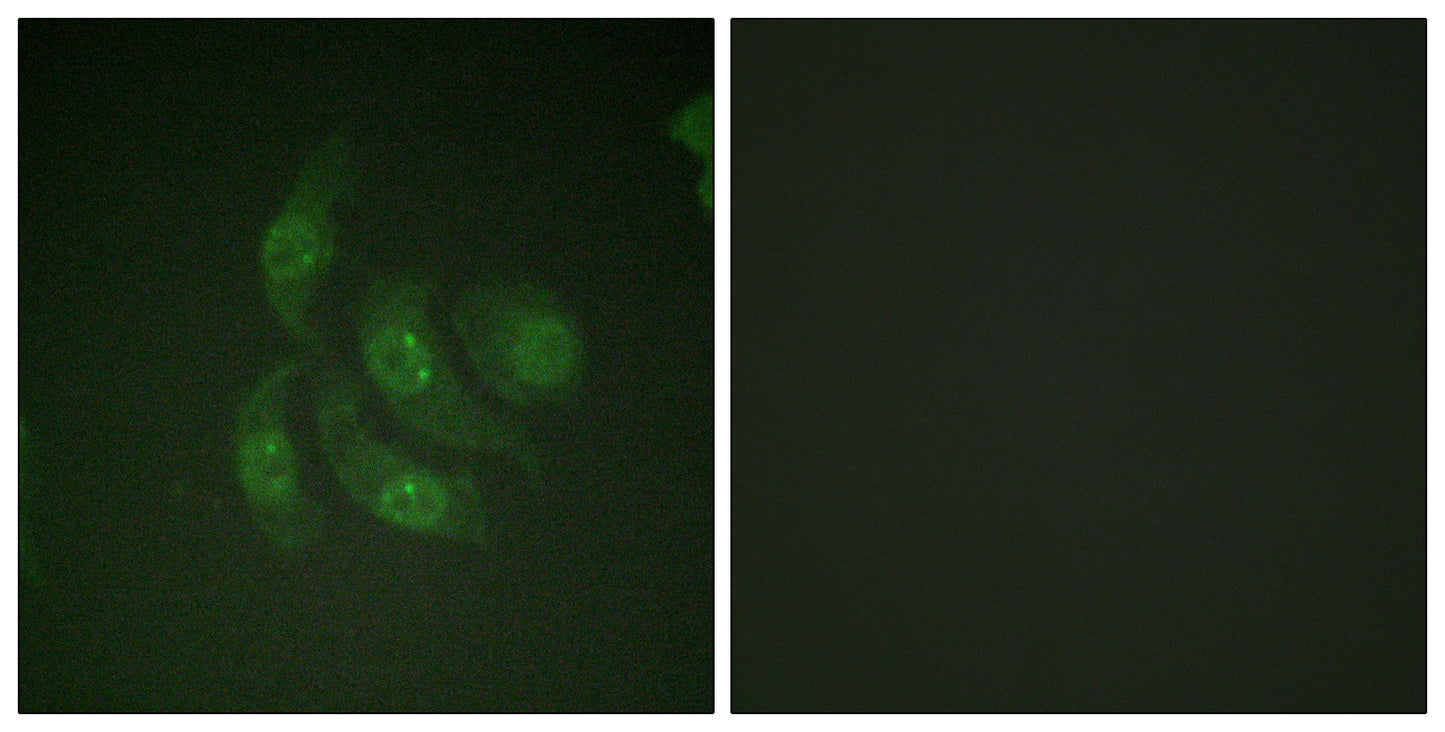 CaMKIV Rabbit Polyclonal Antibody