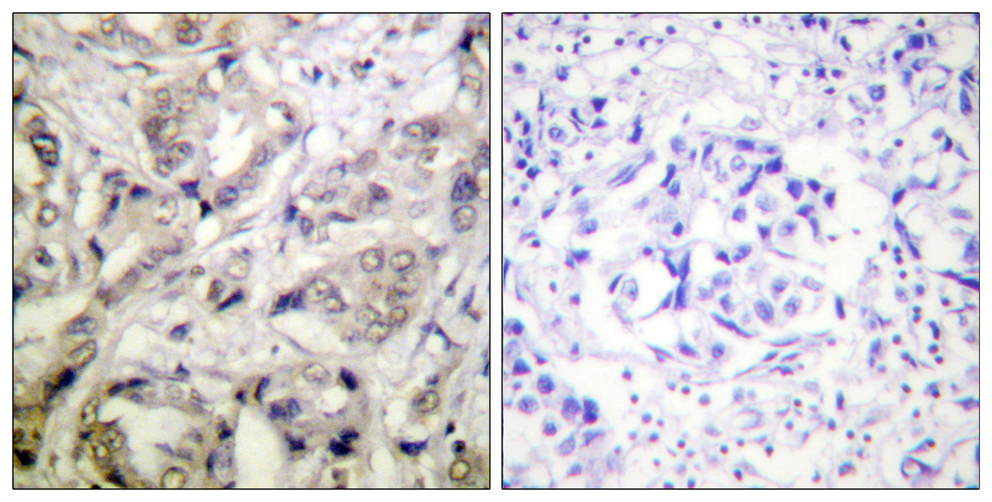 CaMKIα Rabbit Polyclonal Antibody