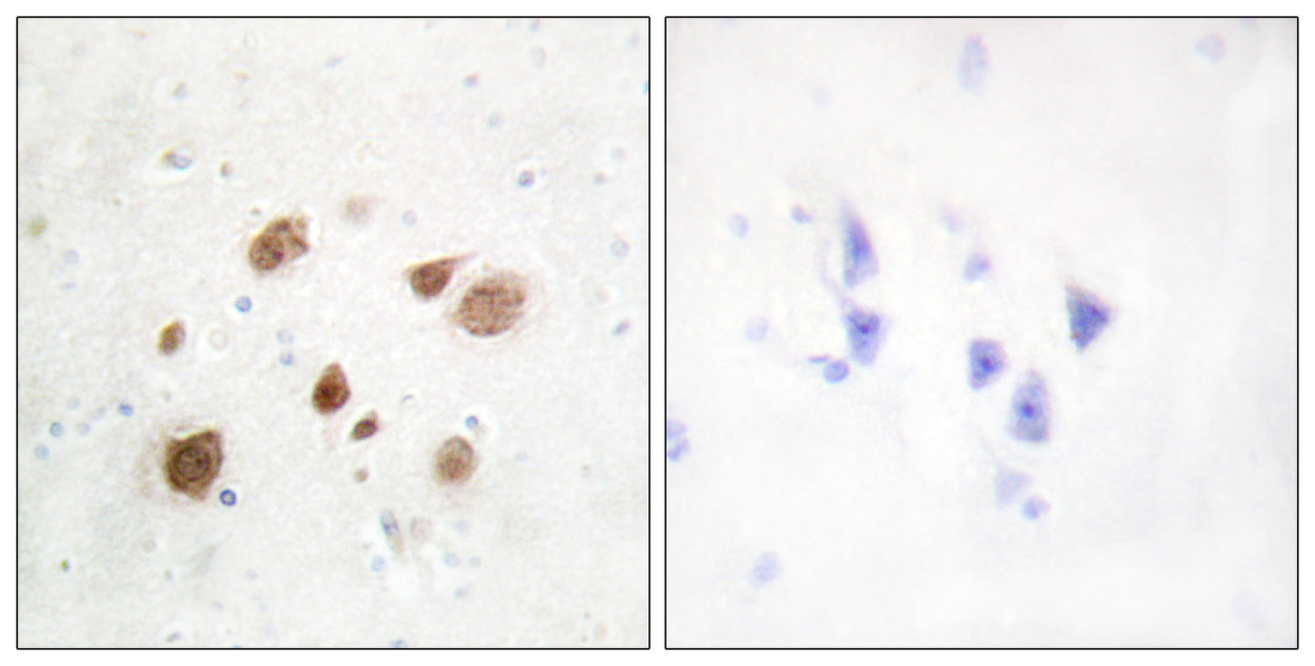 CaMKIβ Rabbit Polyclonal Antibody