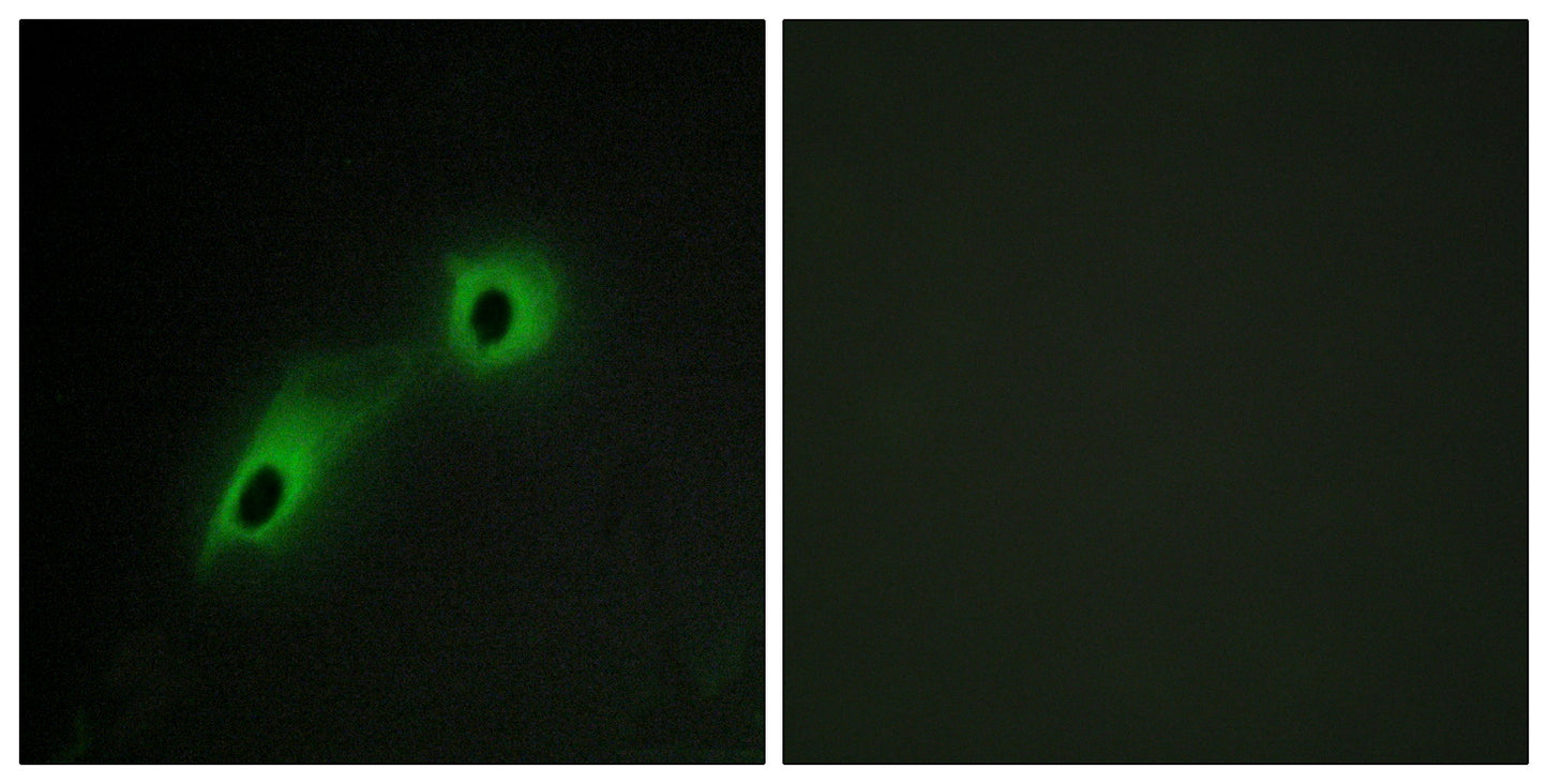 CaMKV Rabbit Polyclonal Antibody