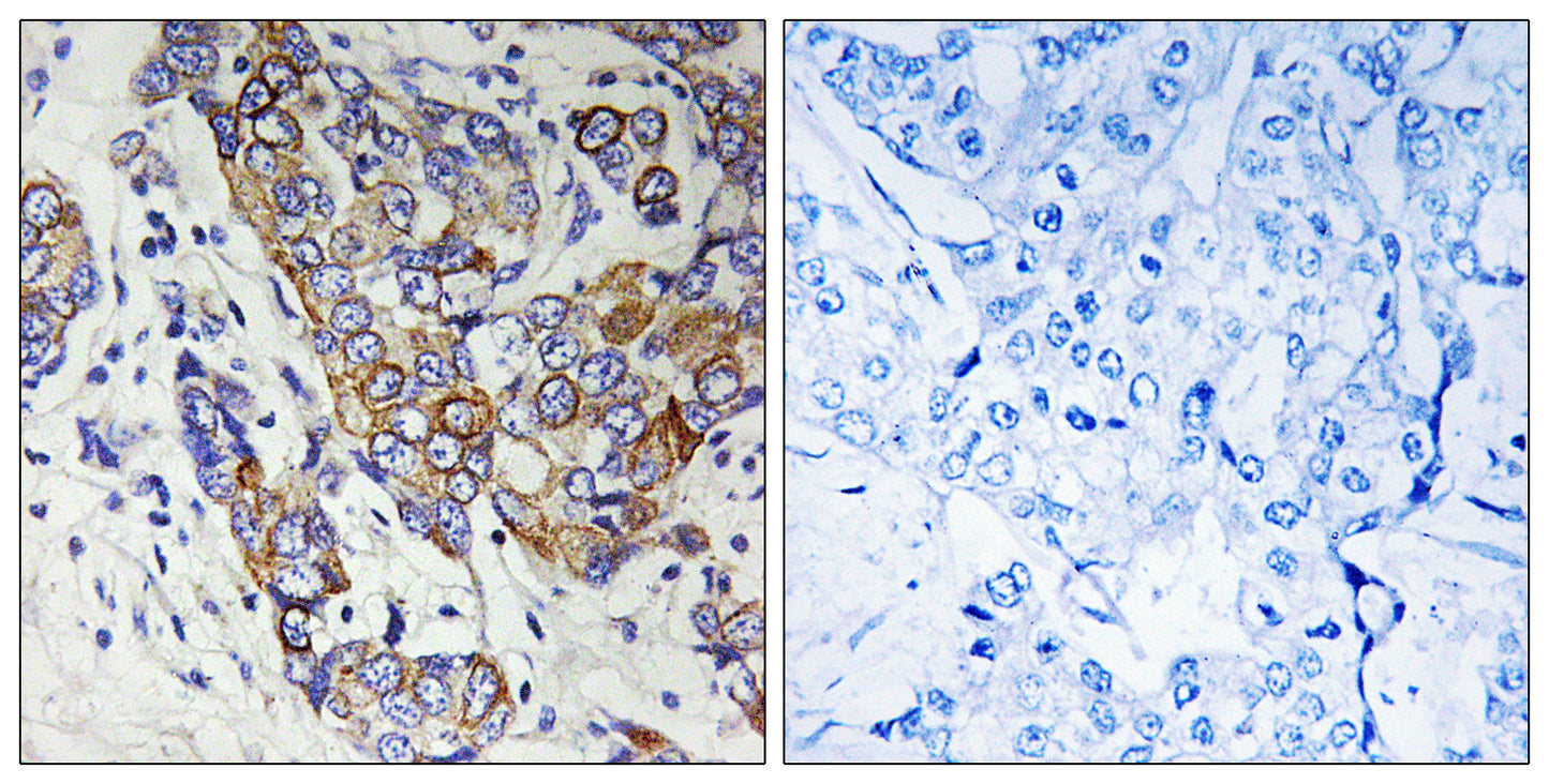 Carbonyl Reductase 1 Rabbit Polyclonal Antibody