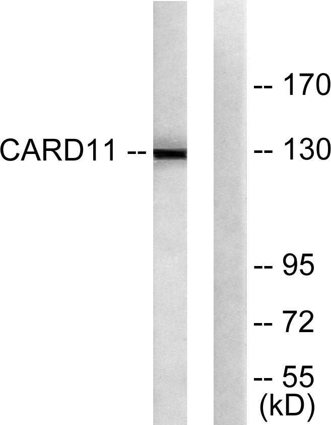 CARD 11 Rabbit Polyclonal Antibody