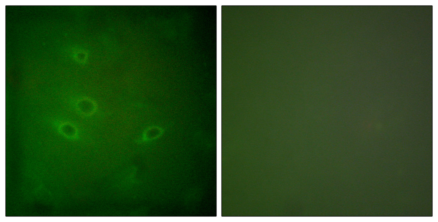 CARD 6 Rabbit Polyclonal Antibody