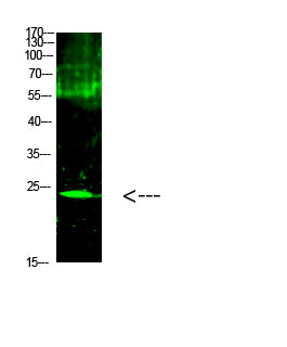 Cardiotrophin-1 Rabbit Polyclonal Antibody