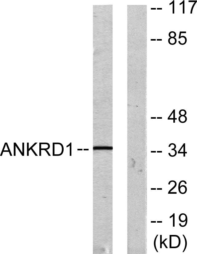 CARP Rabbit Polyclonal Antibody