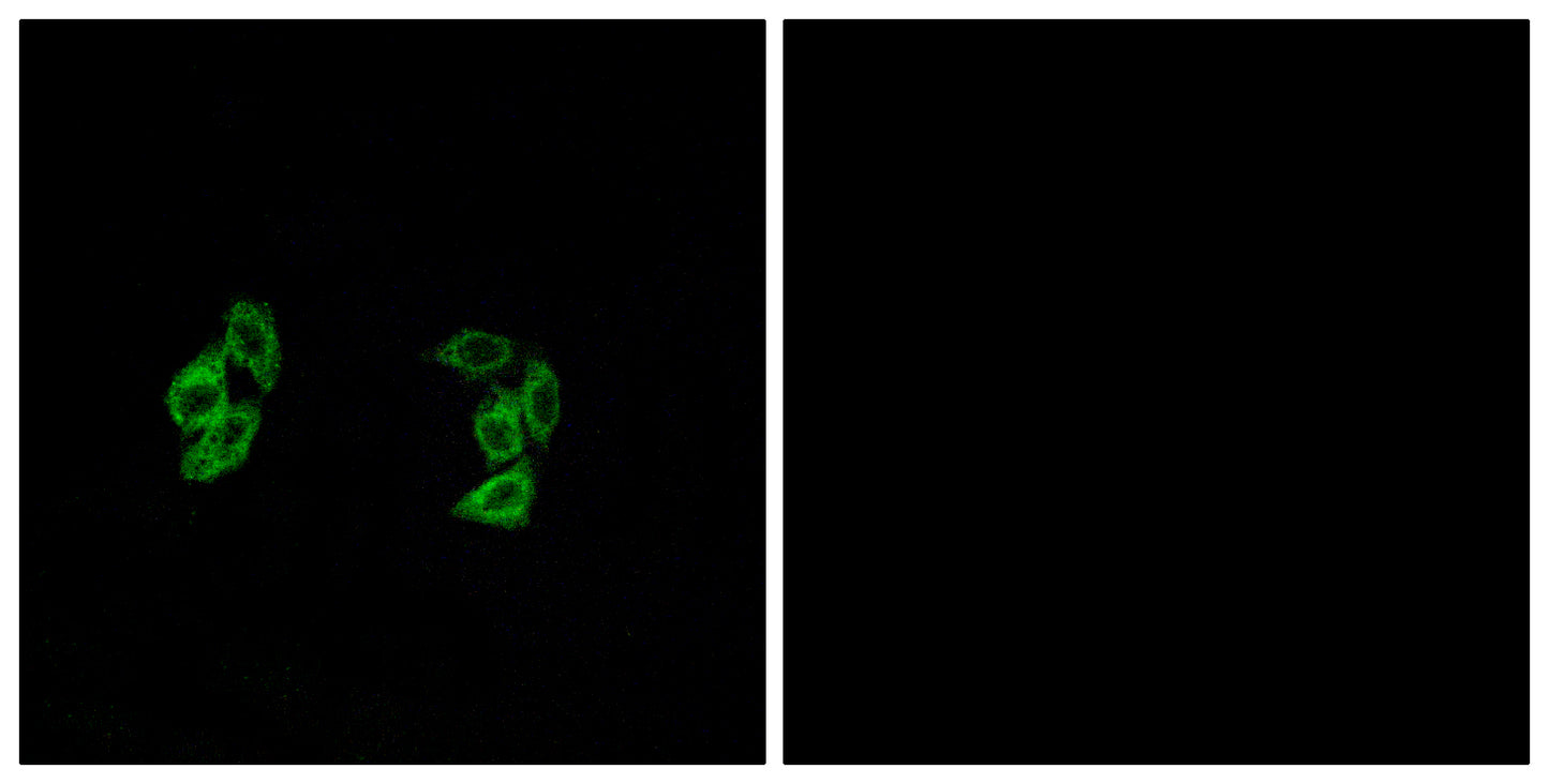 Casein Kinase I α1/1L Rabbit Polyclonal Antibody