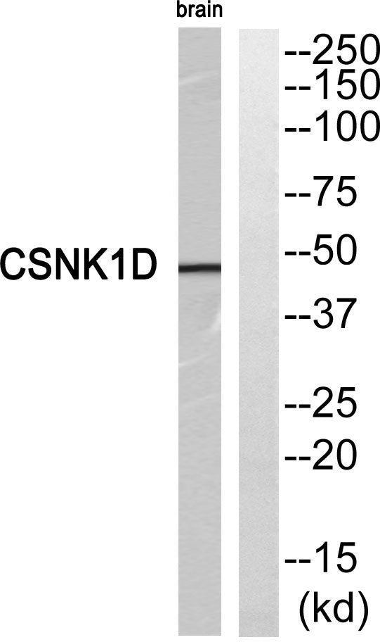 Casein Kinase Iδ Rabbit Polyclonal Antibody