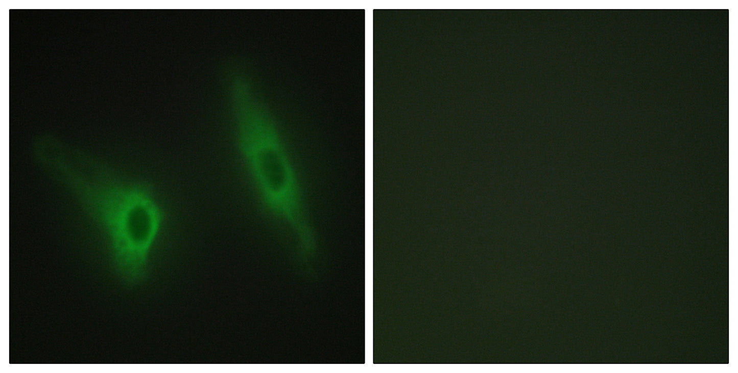 Casein Kinase Iε Rabbit Polyclonal Antibody