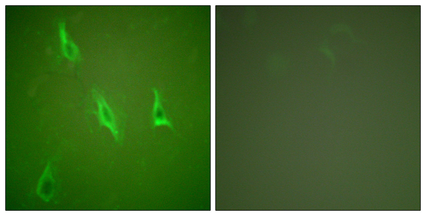 Caspase-10 B/C Rabbit Polyclonal Antibody