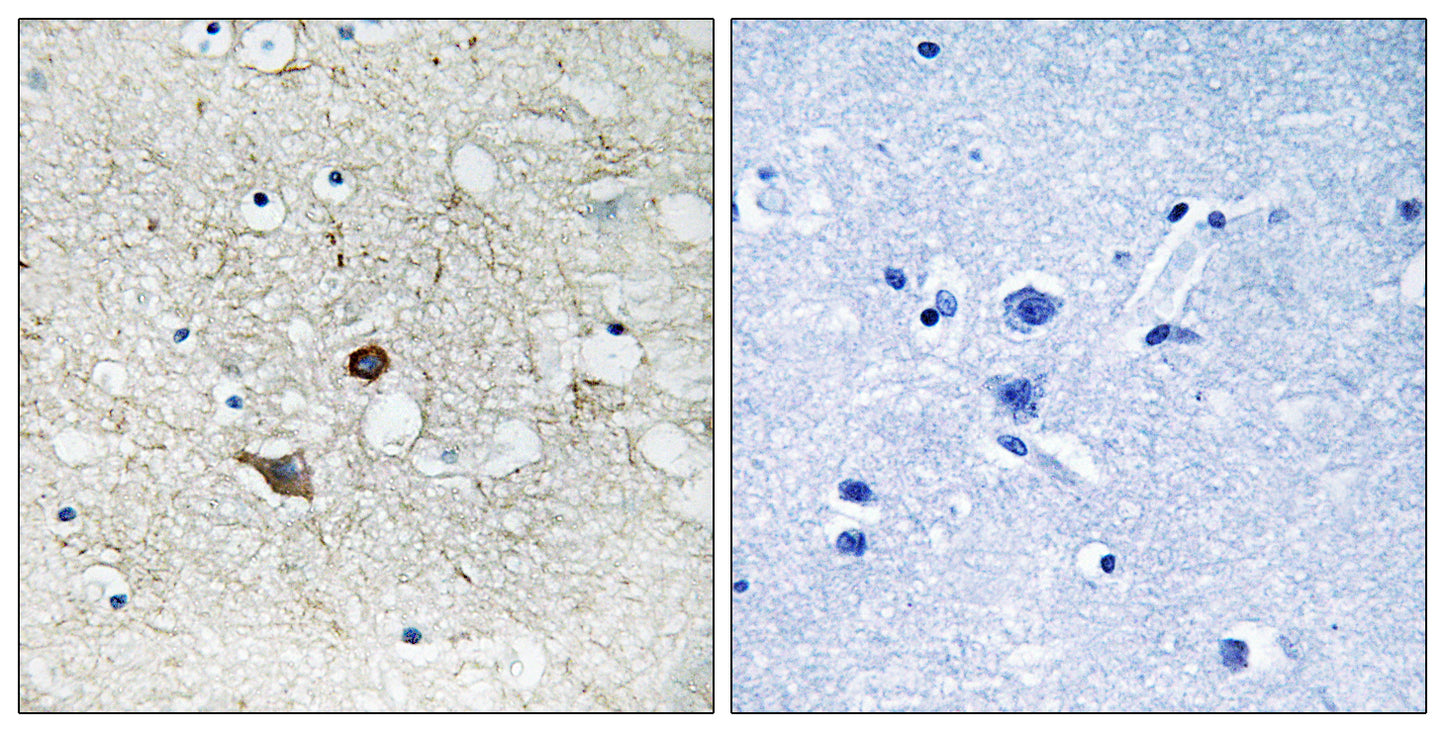 Caspase-2 Rabbit Polyclonal Antibody