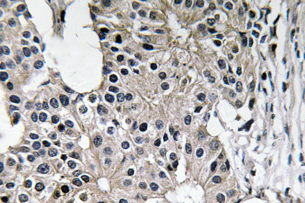 Caspase-7 Rabbit Polyclonal Antibody