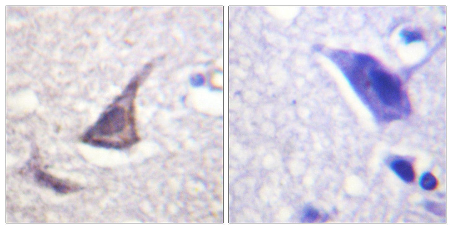 CaSR Rabbit Polyclonal Antibody