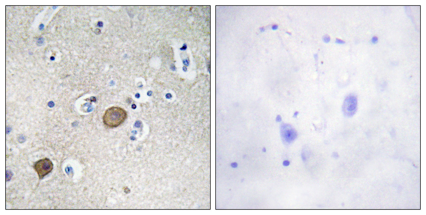 Catenin-α1 Rabbit Polyclonal Antibody