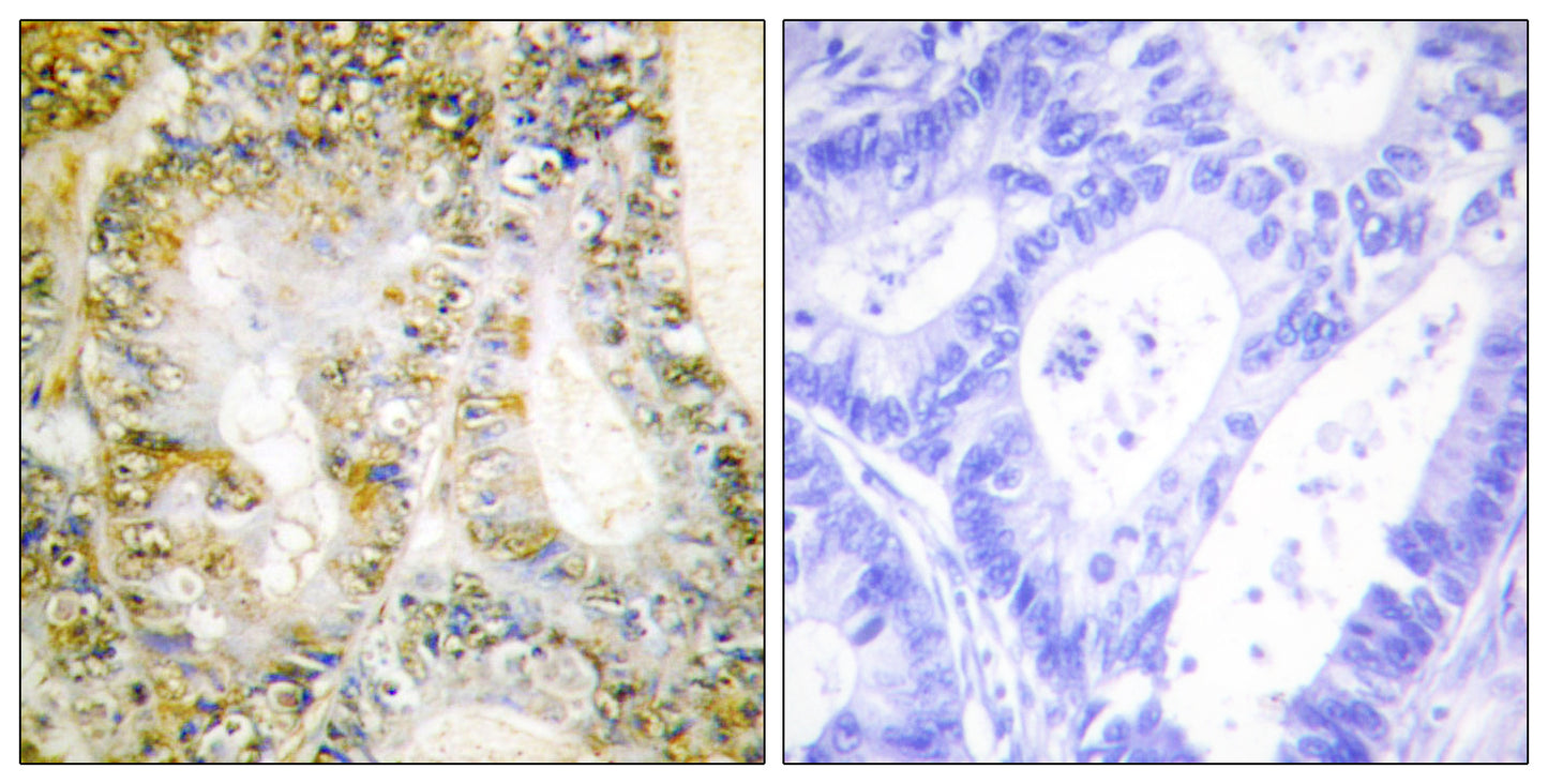 Catenin-β1 Rabbit Polyclonal Antibody