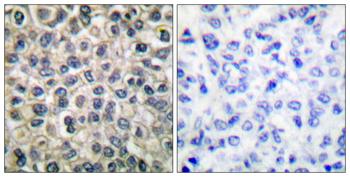 Catenin-γ Rabbit Polyclonal Antibody
