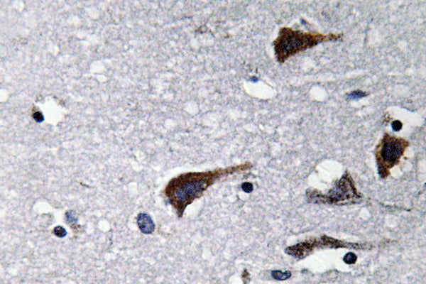 Cathepsin B Rabbit Polyclonal Antibody