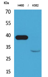 Cathepsin L Rabbit Polyclonal Antibody