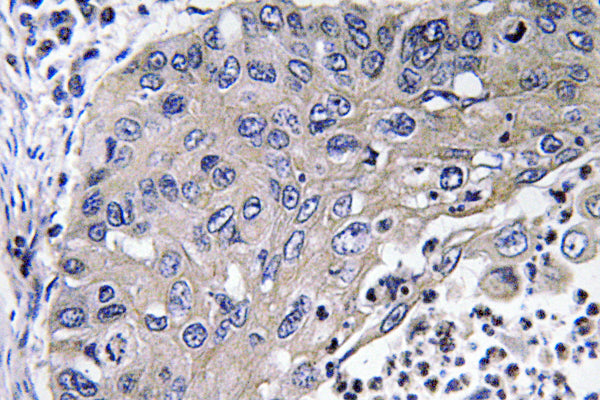 Cathepsin D Rabbit Polyclonal Antibody