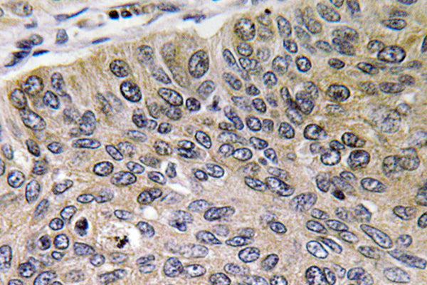 Cathepsin E Rabbit Polyclonal Antibody