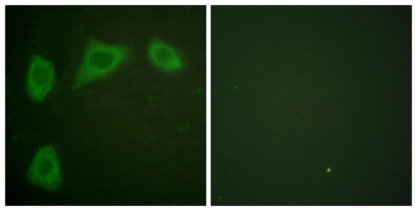 Caveolin-1 Rabbit Polyclonal Antibody