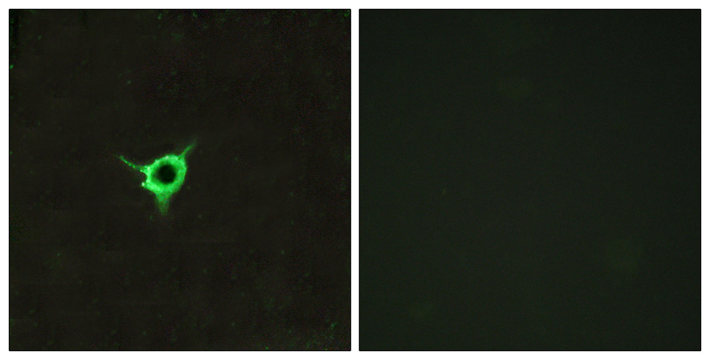 CB1 Rabbit Polyclonal Antibody