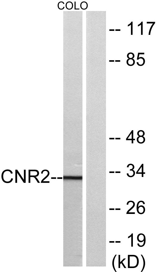 CB2 Rabbit Polyclonal Antibody